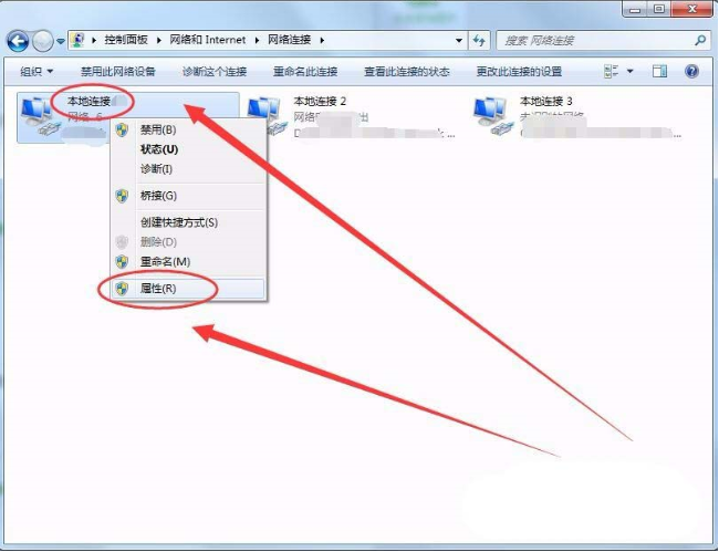 win7系统DNS Server设置不符怎么解决?