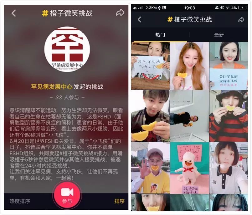 【抖音小飞侠是什么意思】小飞侠是什么病？橙子微笑挑战如何参加