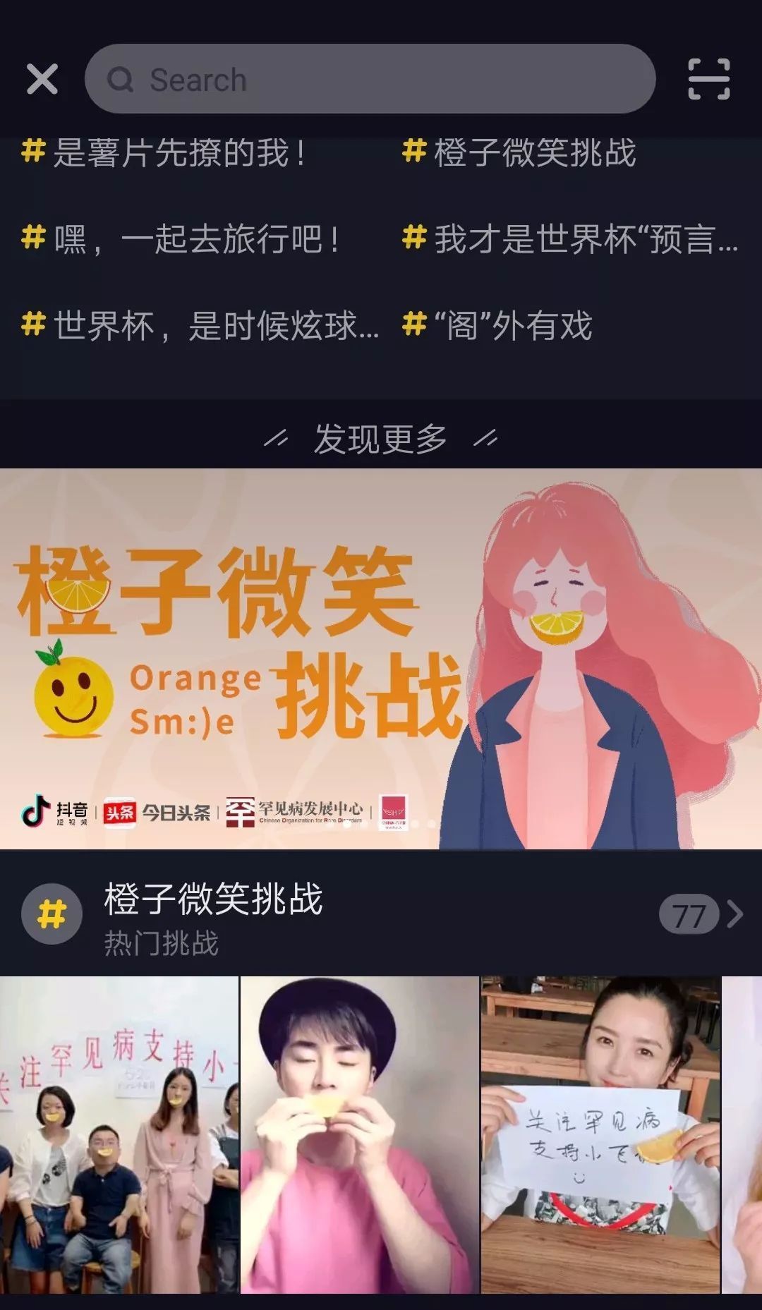 【抖音小飞侠是什么意思】小飞侠是什么病？橙子微笑挑战如何参加